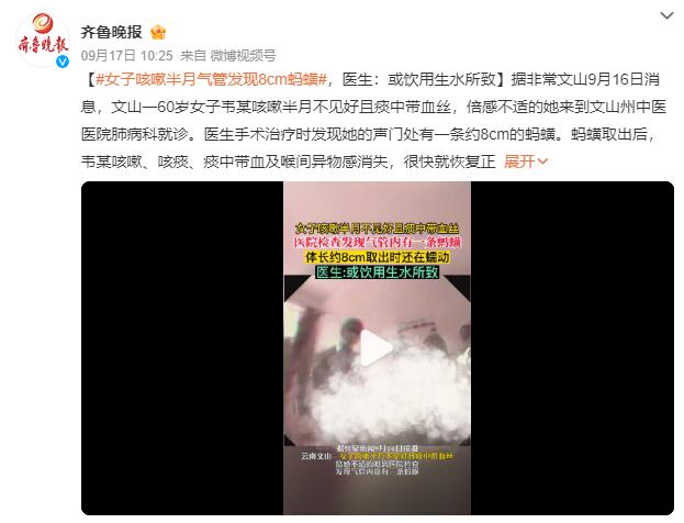 女子咳嗽半月 气管发现8cm蚂蟥：或饮用生水所致