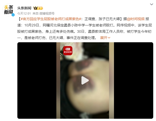 官方调查学生屁股被老师打成黑紫色：是被老师打伤，已无大碍，事件正在调查处理