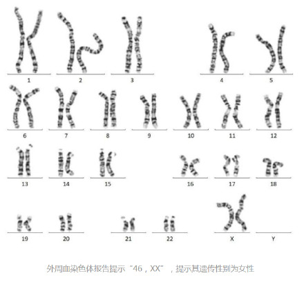 眼见不一定为实！夫妻同床5年 发现丈夫染色体是女性